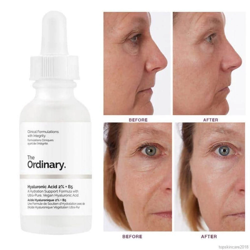 The Ordinaryسرم هیالورونیک اسید اوردینری برای پوست خشک