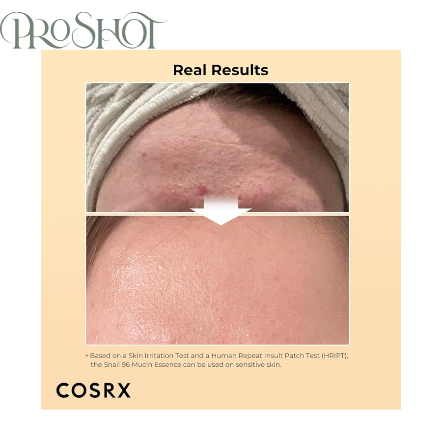 سرم Essence COSRX برای آبرسانی، ترمیم و مراقبت پوست روزانه