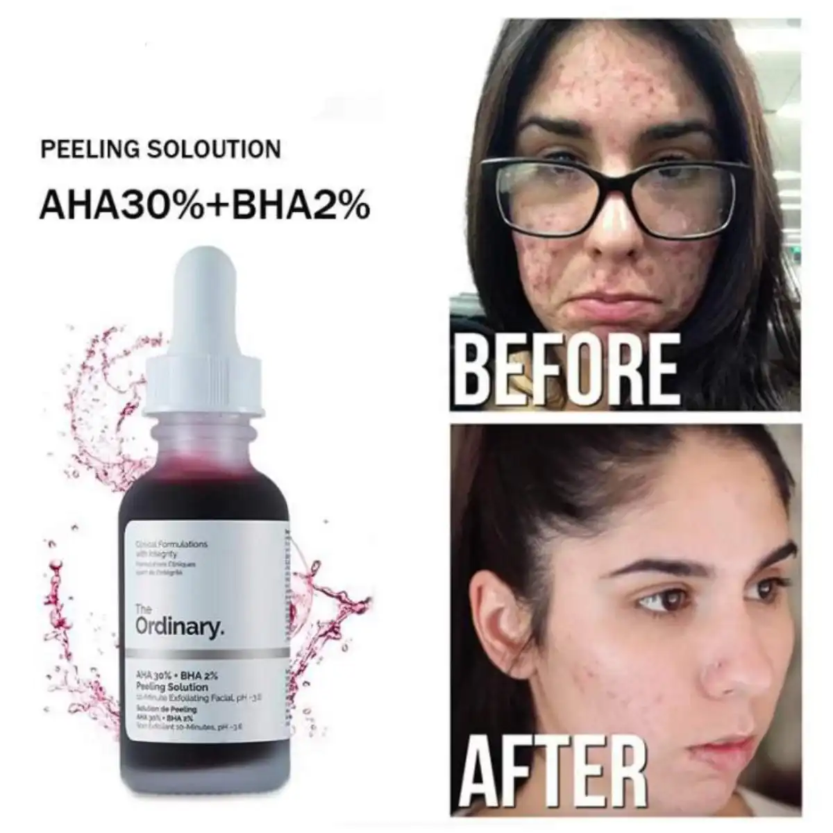 The Ordinary سرم پیلینگ لایه بردار قوی AHA30% - تصویر 2