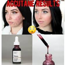 The Ordinary سرم پیلینگ لایه بردار قوی AHA30% - تصویر 4